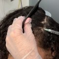 Scalp Treatments for Hair Growth: How to Speed Up the Process and Get a Cash Offer