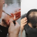 Smoking and Hair Loss: What You Need to Know