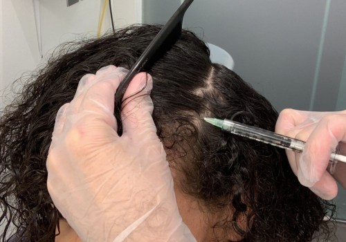 Scalp Treatments for Hair Growth: How to Speed Up the Process and Get a Cash Offer