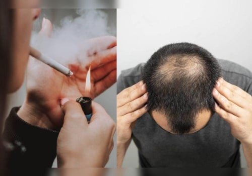 Smoking and Hair Loss: What You Need to Know