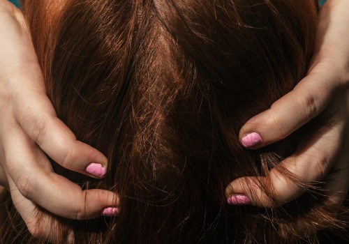 Menopause and Hair Loss: What You Need to Know